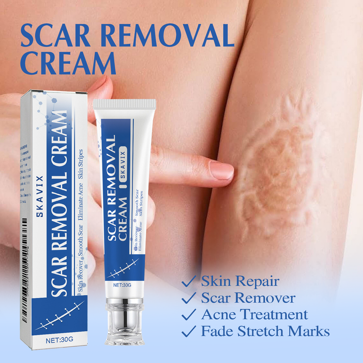 🔥SKAVIX™Professional Scar Removal Gel- Scarremoval treatment for keloids, C-sectionS, surgeries, burns, acne andmore.